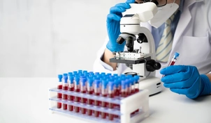 Doctor examining blood samples under a microscope for PSA and PSE blood tests, essential for prostate cancer diagnostics.