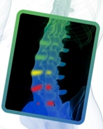 spinal-diagnostics